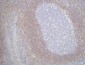 Bcl-2 Monoclonal Antibody(6B5)